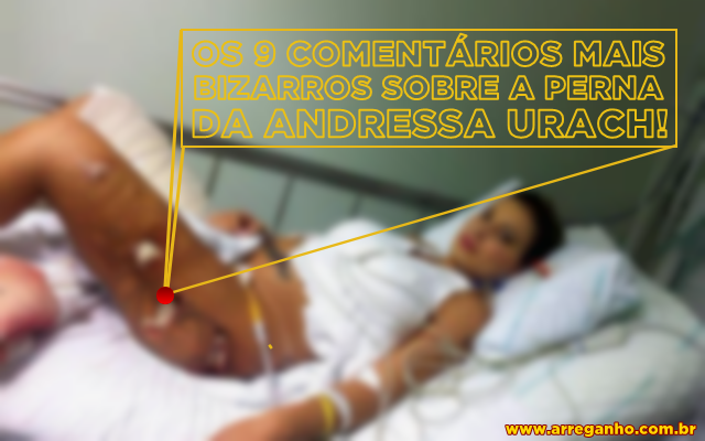 Os 9 comentários mais bizarros sobre a perna da Andressa Urach!